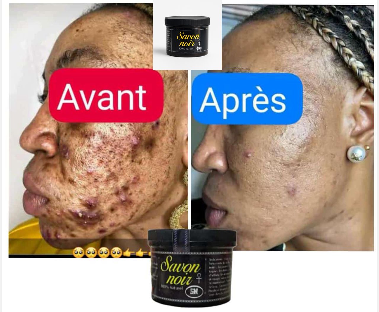 SAVON NOIR ANTI-TACHE bn
