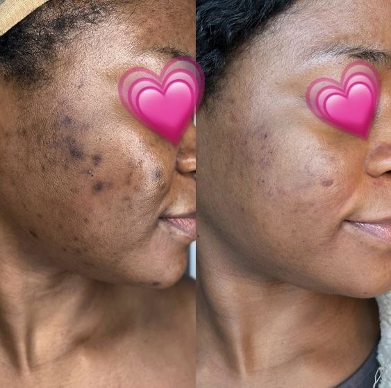 SAVON NOIR ANTI-TACHE Civ