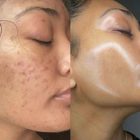 Collagène de nuit  Anti-imperfection