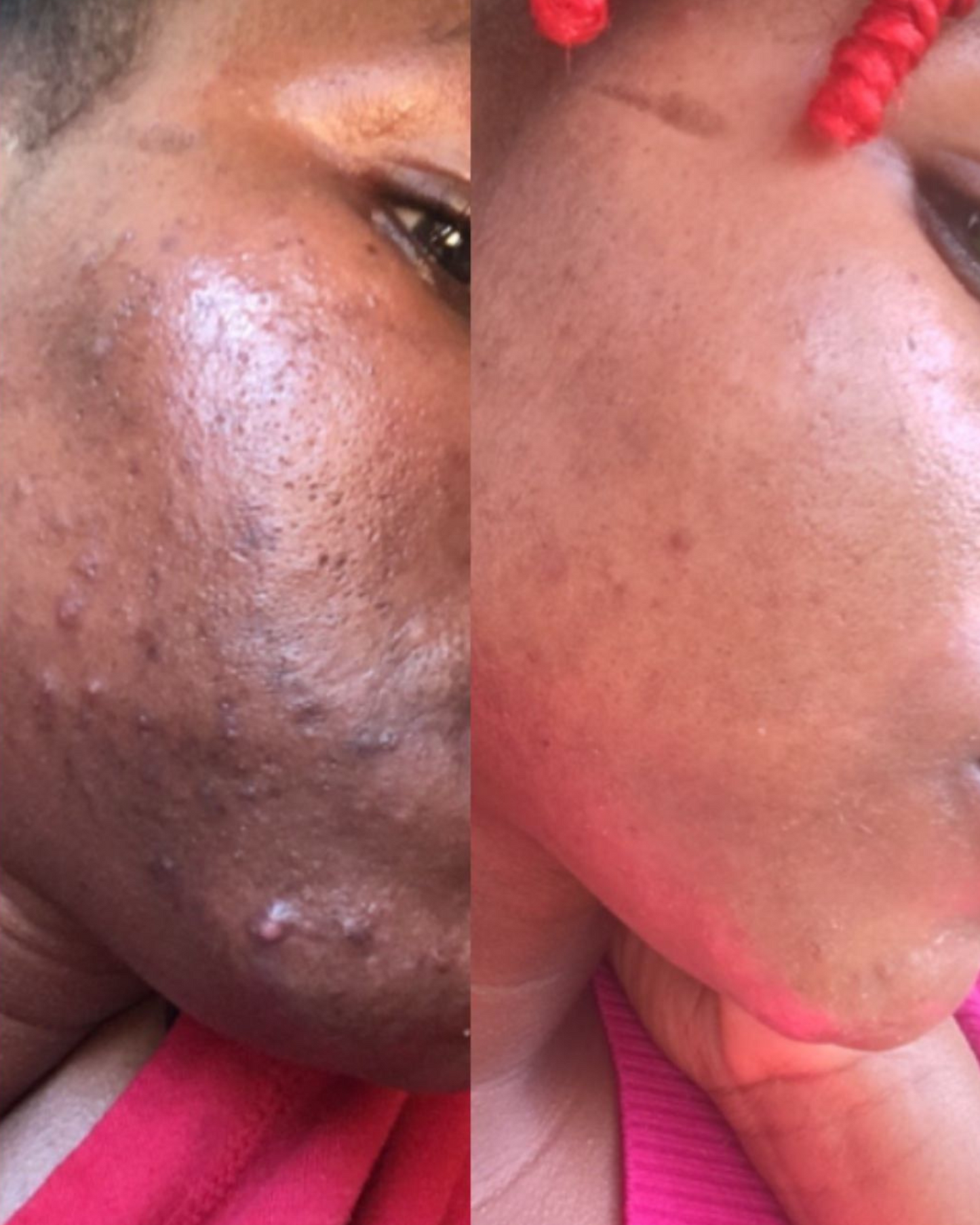 SAVON NOIR ANTI-TACHE Gb