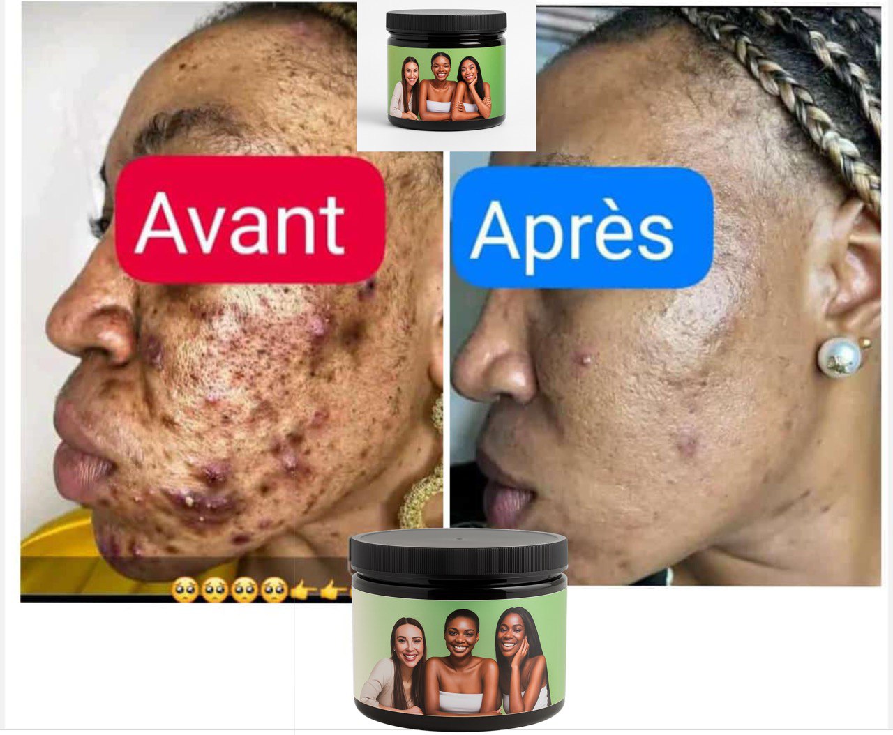 SAVON NOIR ANTI-TACHE Gb