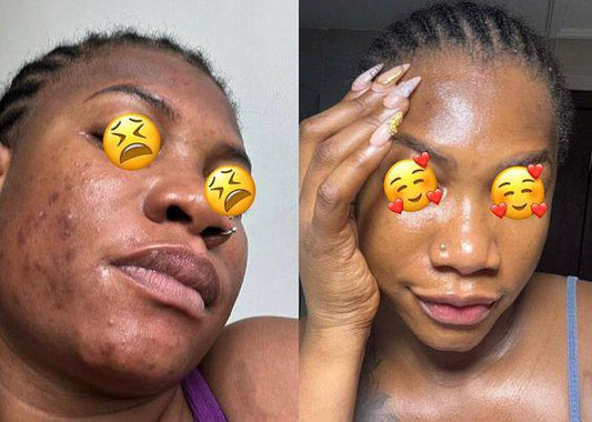 SAVON NOIR ANTI-TACHE Civ