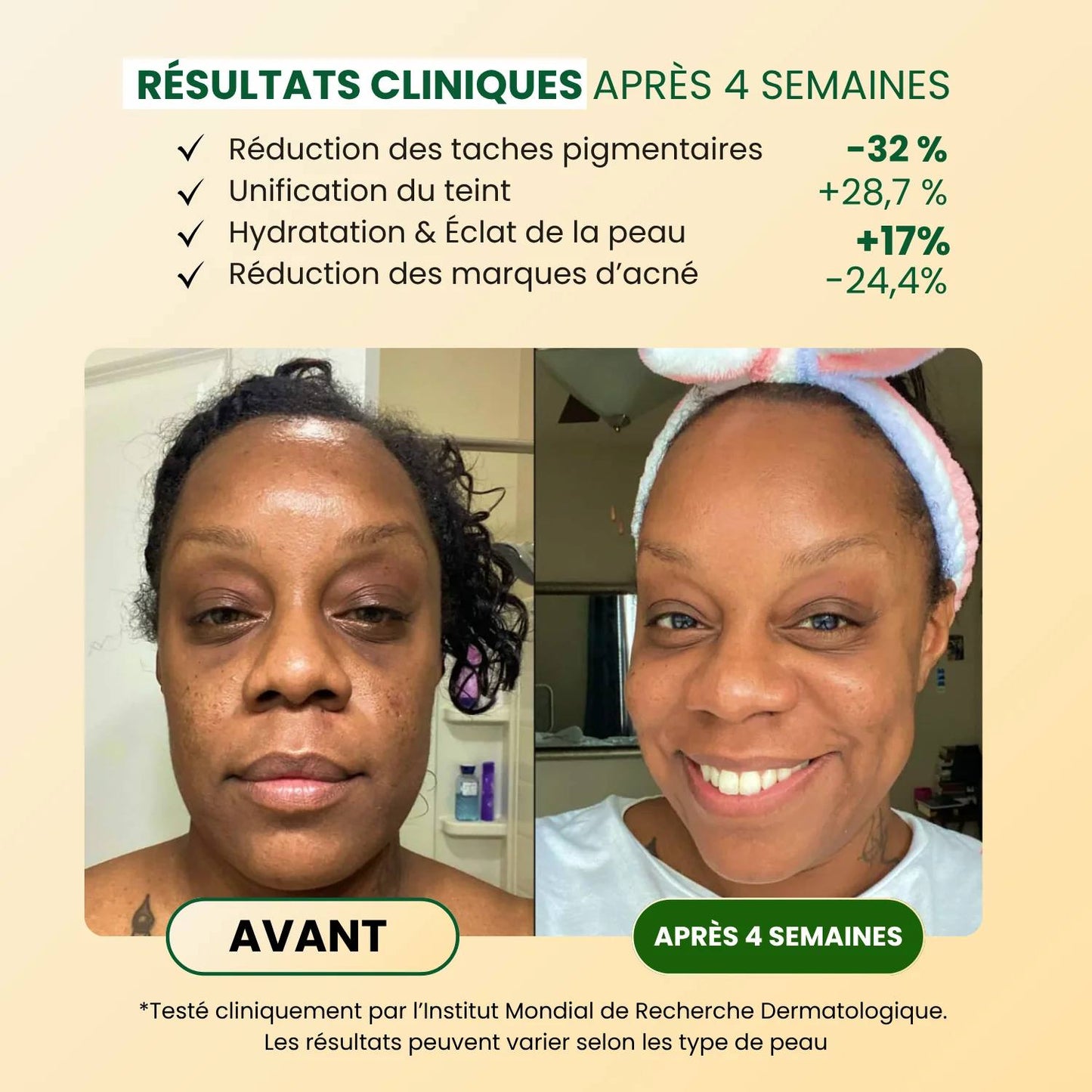 Savon Anti-Taches Au Curcuma (100g + 100g OFFERTS)