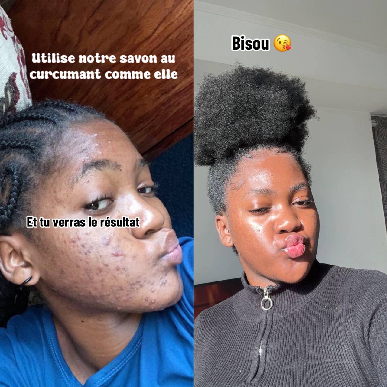 Savon Anti-Taches Au Curcuma (100g + 100g OFFERTS)